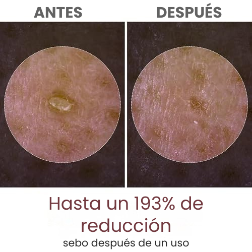 Dr Melaxin - Adios puntos negros y manchas en la piel